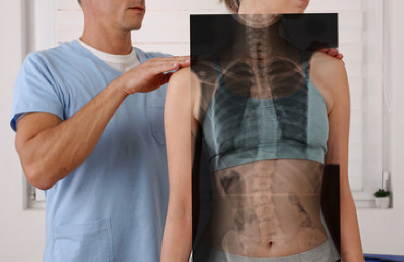 Tratamento de Podoposturologia Marcar Morumbi - Fisioterapia para Melhorar a Postura